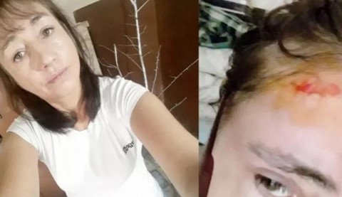 ¡Todos por Adriana! Padece una rara enfermedad y necesita ayuda