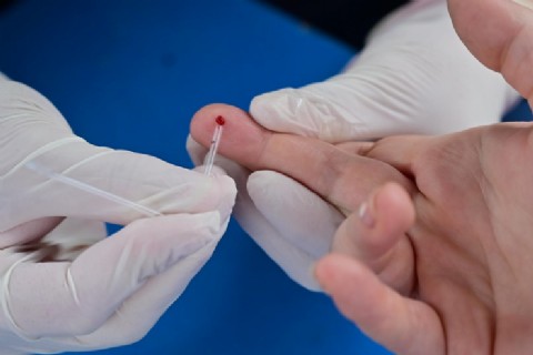 Jornada de testeo de HIV y sífilis