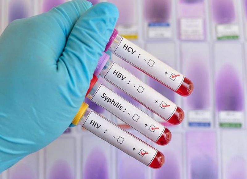 VIH y sífilis en alza: alarma sanitaria en la ciudad y la región